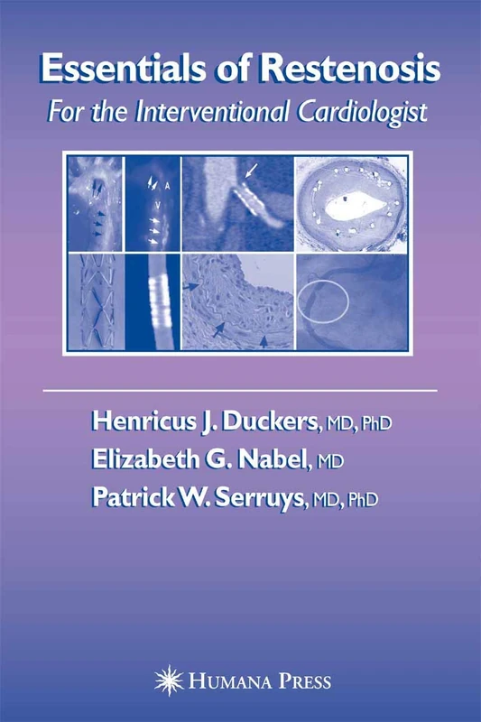 Essentials of Restenosis: For the Interventional Cardiologist (Contemporary Cardiology)