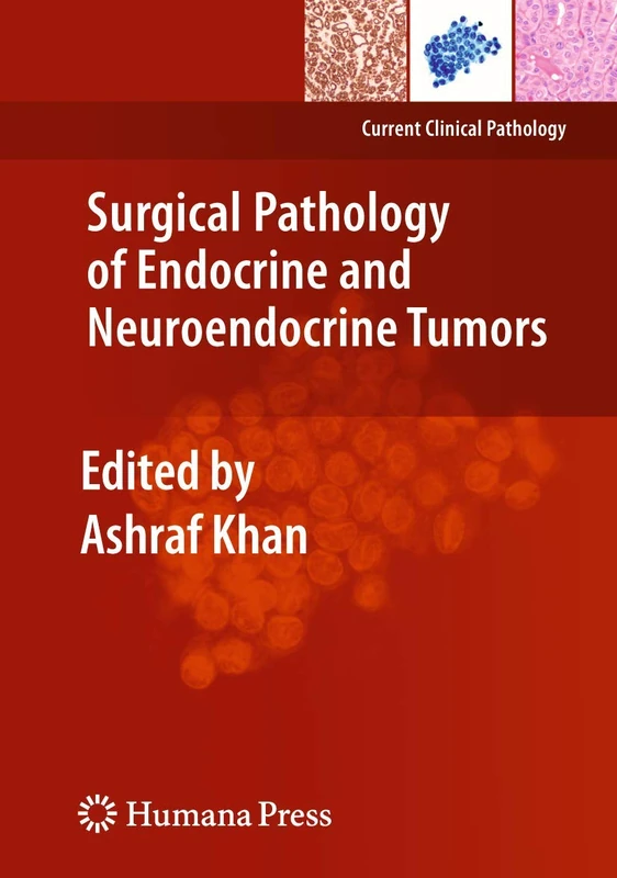 Humana Surgical Pathology of Endocrine and Neuroendocrine Tumors