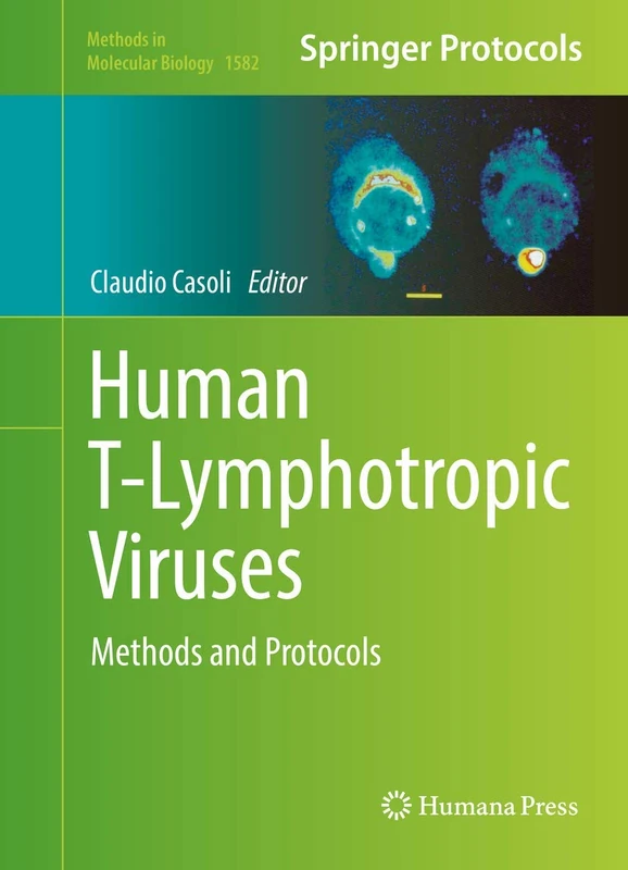 Human T-Lymphotropic Viruses: Methods and Protocols: 1582 (Methods in Molecular Biology, 1582)