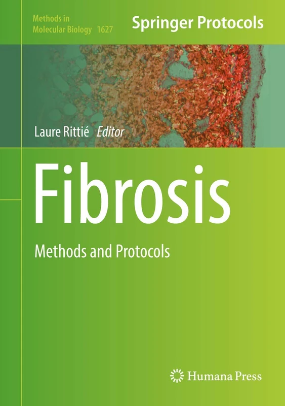 Fibrosis: Methods and Protocols: 1627 (Methods in Molecular Biology, 1627)