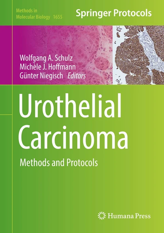 Urothelial Carcinoma: Methods and Protocols: 1655 (Methods in Molecular Biology, 1655)