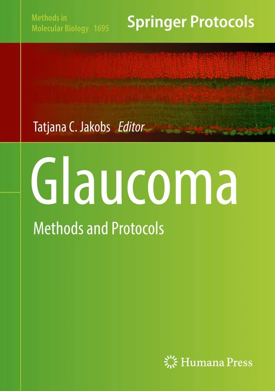 Glaucoma: Methods and Protocols: 1695 (Methods in Molecular Biology, 1695)
