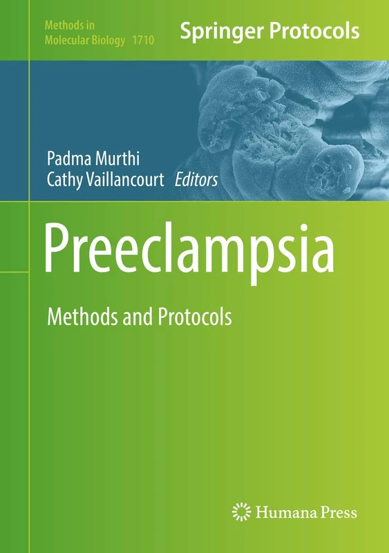 Humana Preeclampsia: Methods and Protocols 1710 Book