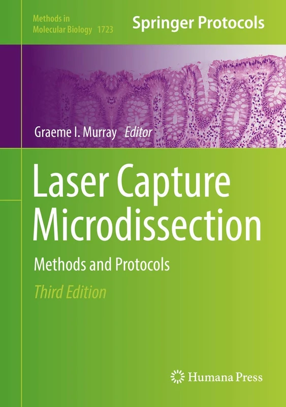 Laser Capture Microdissection: Methods and Protocols: 1723 (Methods in Molecular Biology, 1723)