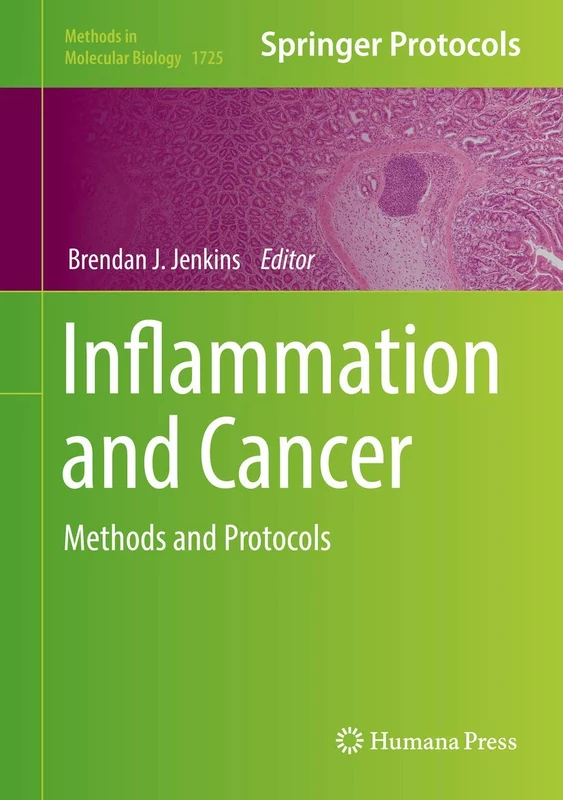 Inflammation and Cancer: Methods and Protocols: 1725 (Methods in Molecular Biology, 1725)