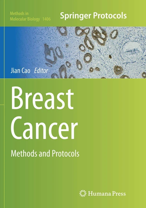 Breast Cancer: Methods and Protocols: 1406 (Methods in Molecular Biology, 1406)