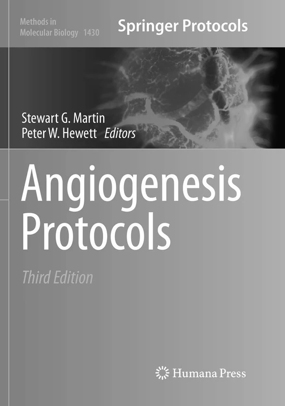 Angiogenesis Protocols: 1430 (Methods in Molecular Biology, 1430)