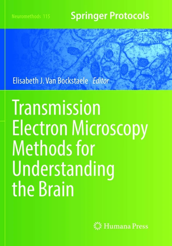 Transmission Electron Microscopy Methods for Understanding the Brain: 115 (Neuromethods, 115)