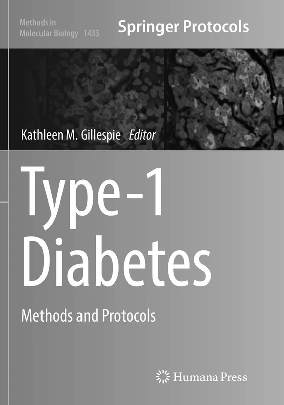 Type-1 Diabetes: Methods and Protocols: 1433 (Methods in Molecular Biology, 1433)