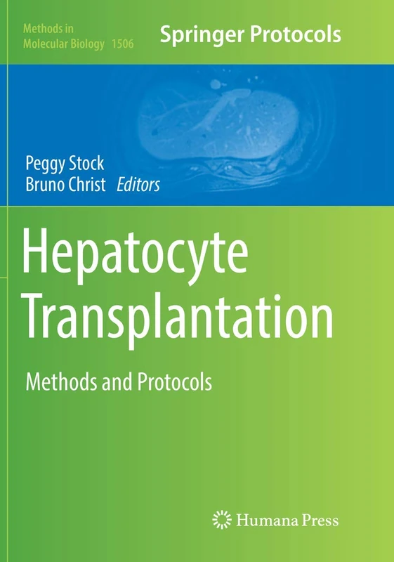 Hepatocyte Transplantation: Methods and Protocols: 1506 (Methods in Molecular Biology, 1506)