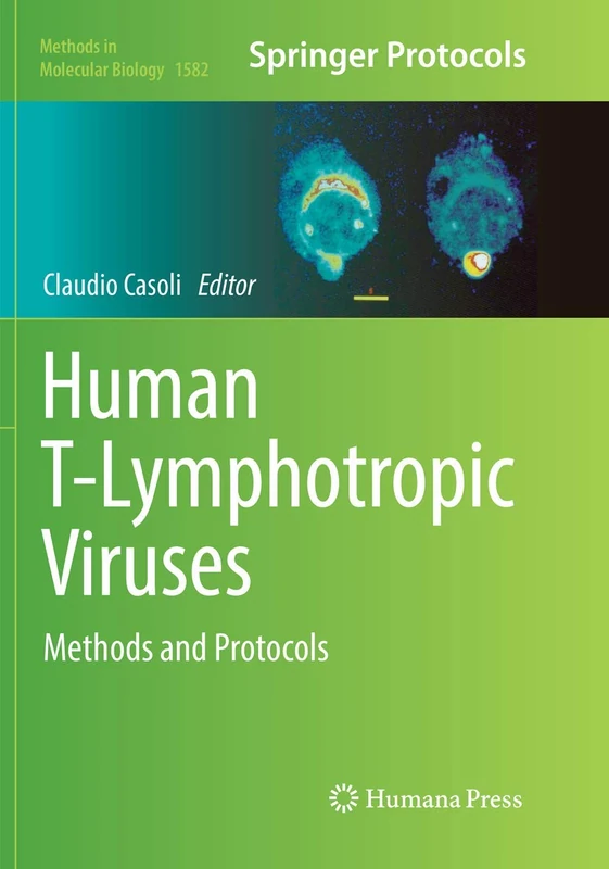 Human T-Lymphotropic Viruses: Methods and Protocols: 1582 (Methods in Molecular Biology)