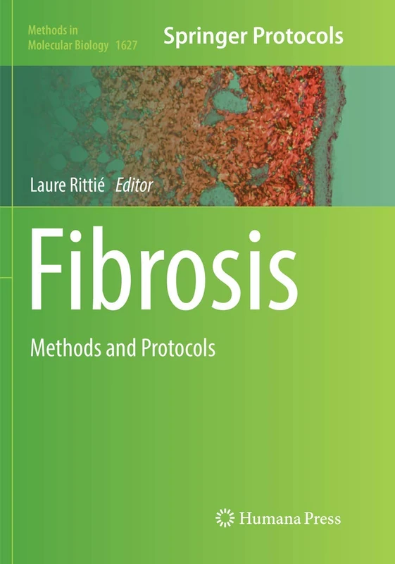 Humana Fibrosis: Methods and Protocols 1627 - Science Book