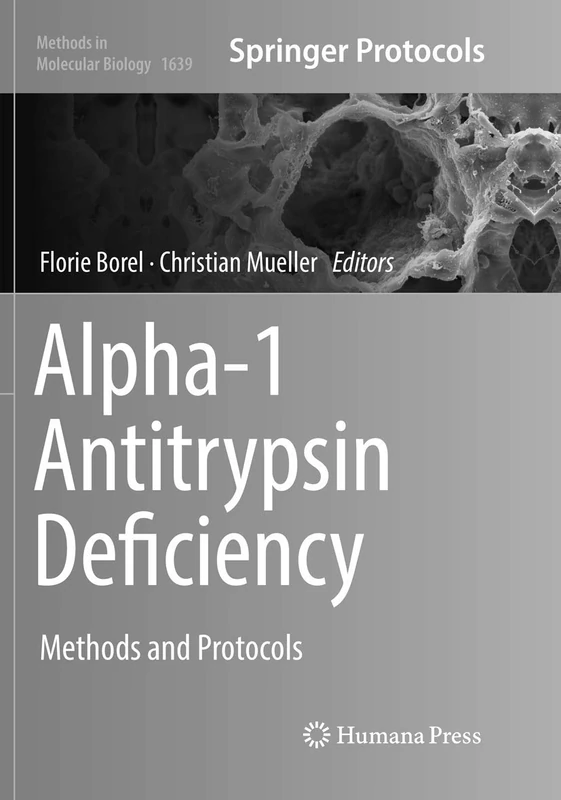 Alpha-1 Antitrypsin Deficiency: Methods and Protocols: 1639 (Methods in Molecular Biology, 1639)