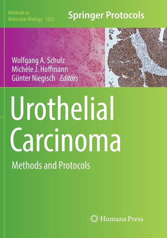 Urothelial Carcinoma: Methods and Protocols: 1655 (Methods in Molecular Biology, 1655)