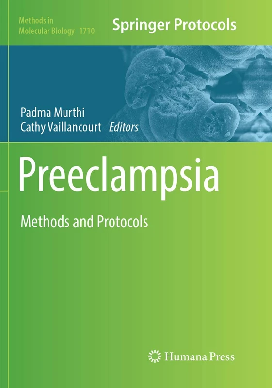 Preeclampsia: Methods and Protocols: 1710 (Methods in Molecular Biology, 1710)