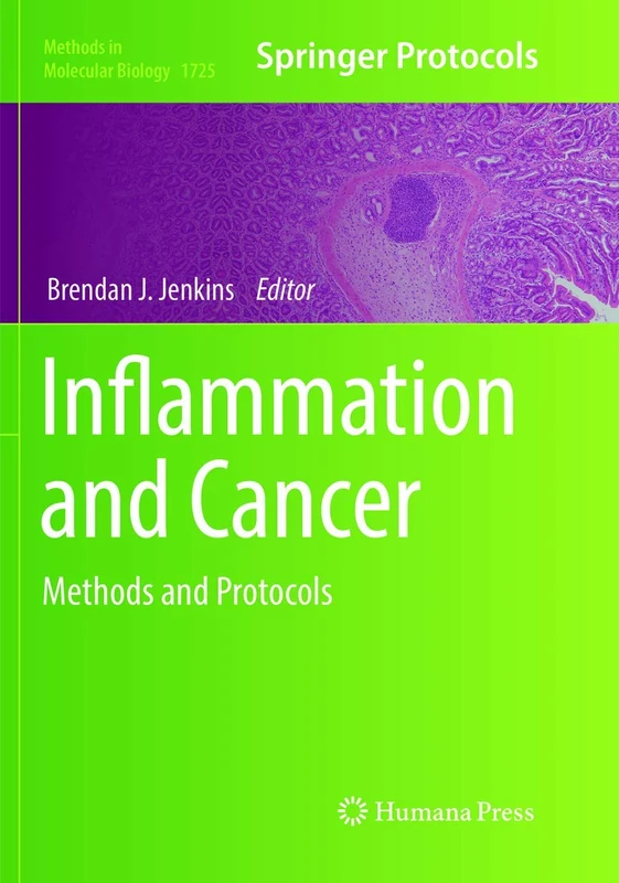 Inflammation and Cancer: Methods and Protocols: 1725 (Methods in Molecular Biology, 1725)