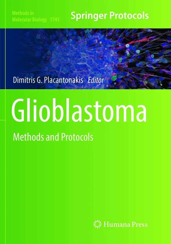 Glioblastoma: Methods and Protocols: 1741 (Methods in Molecular Biology, 1741)