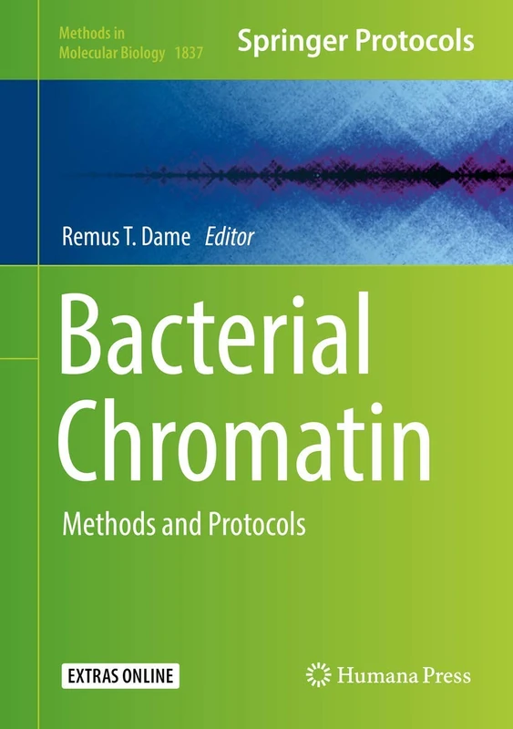 Humana Bacterial Chromatin: Methods and Protocols 1837
