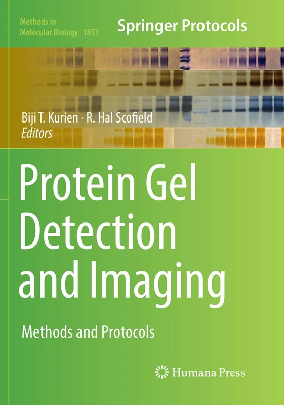 Protein Gel Detection and Imaging: Methods and Protocols: 1853 (Methods in Molecular Biology, 1853)
