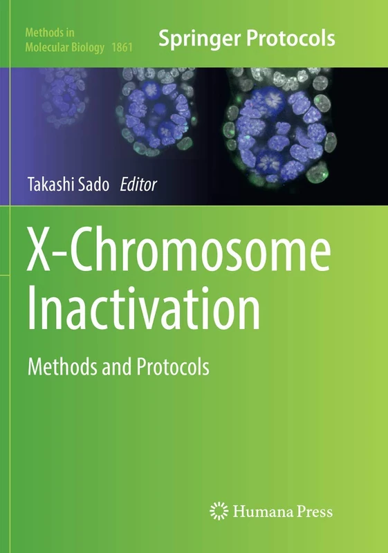 X-Chromosome Inactivation: Methods and Protocols: 1861 (Methods in Molecular Biology, 1861)