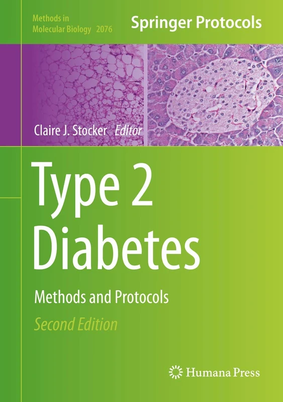Humana Type 2 Diabetes: Methods and Protocols 2076 Book