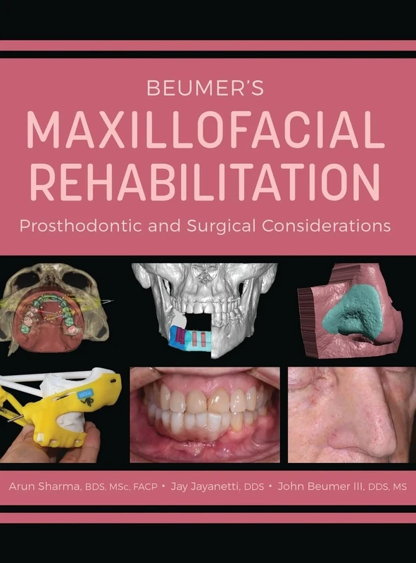 Beumer's Maxillofacial Rehabilitation: Prosthodontics and Surgical Considerations