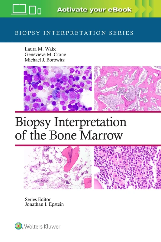 Biopsy Interpretation of the Bone Marrow: Print + eBook with Multimedia (Biopsy Interpretation Series)