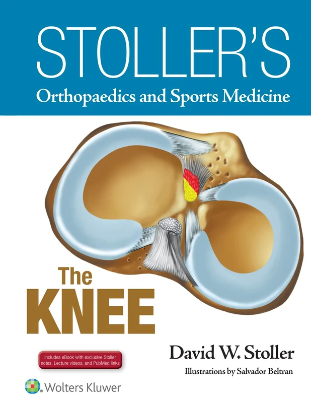 Stoller's Orthopaedics and Sports Medicine: The Knee: Includes Stoller Lecture Videos and Stoller Notes (Stollers Orthopaedics & Sports)
