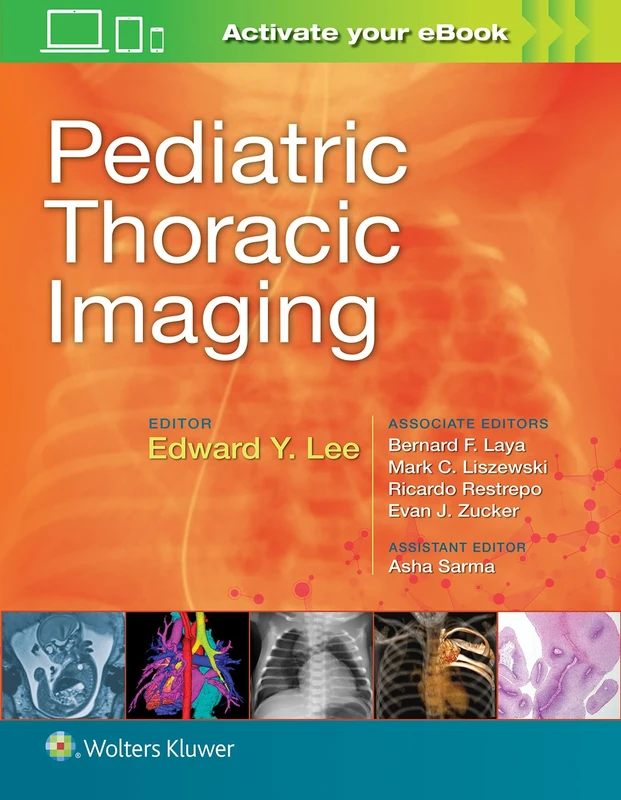 Pediatric Thoracic Imaging