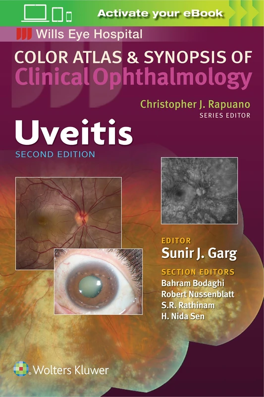Lippincott Uveitis Color Atlas & Synopsis of Ophthalmology