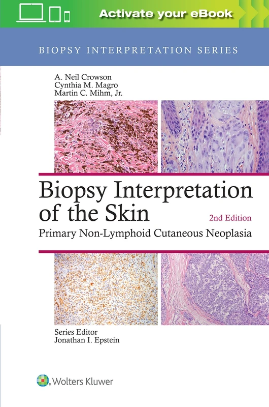 Biopsy Interpretation of the Skin: Primary Non-Lymphoid Cutaneous Neoplasia (Biopsy Interpretation Series)