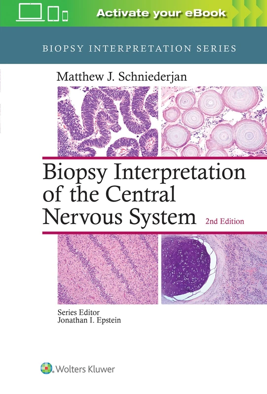 Lippincott Biopsy Interpretation of the Central Nervous System - Image 1