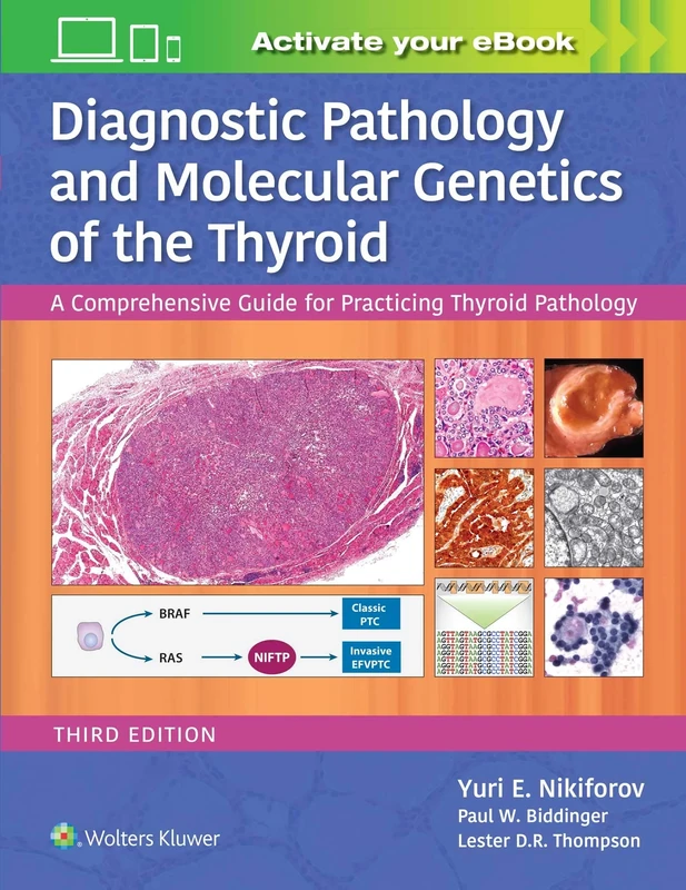 Diagnostic Pathology and Molecular Genetics of the Thyroid: A Comprehensive Guide for Practicing Thyroid Pathology