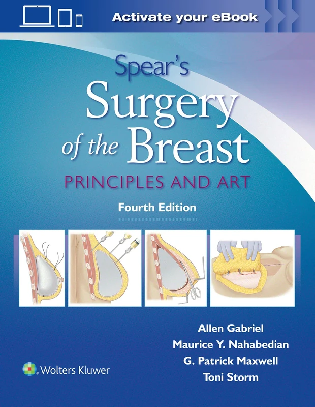 Spear's Surgery of the Breast: Principles and Art