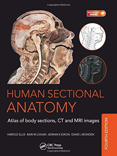 Human Sectional Anatomy: Atlas of Body Sections, CT and MRI Images, Fourth Edition