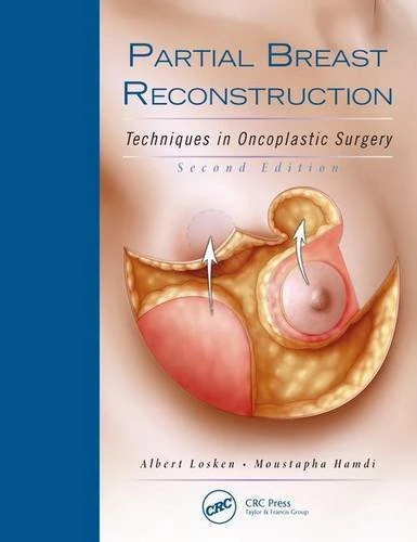 Partial Breast Reconstruction: Techniques in Oncoplastic Surgery, 2nd Edition