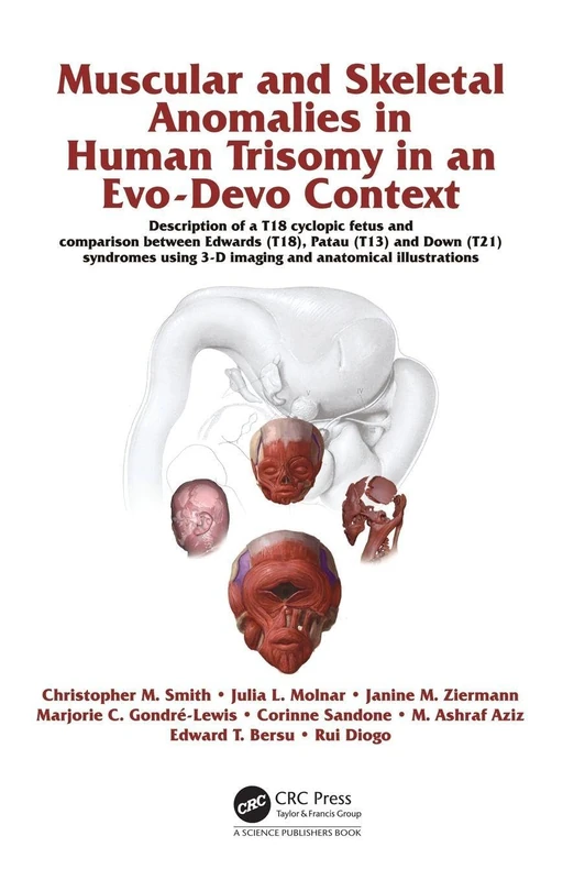 Muscular and Skeletal Anomalies in Human Trisomy in an Evo-Devo Context: Description of a T18 Cyclopic Fetus and Comparison Between Edwards (T18), ... 3-D Imaging and Anatomical Illustrations