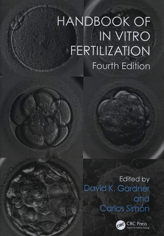 Handbook of In Vitro Fertilization
