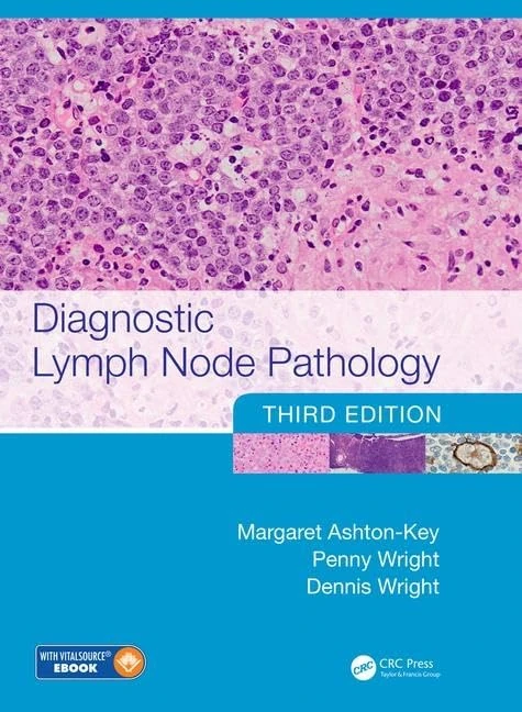 Diagnostic Lymph Node Pathology: Contains Ebook Access