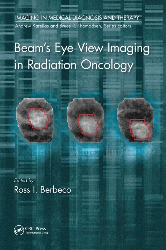 Beam's Eye View Imaging in Radiation Oncology (Imaging in Medical Diagnosis and Therapy) - Image 1