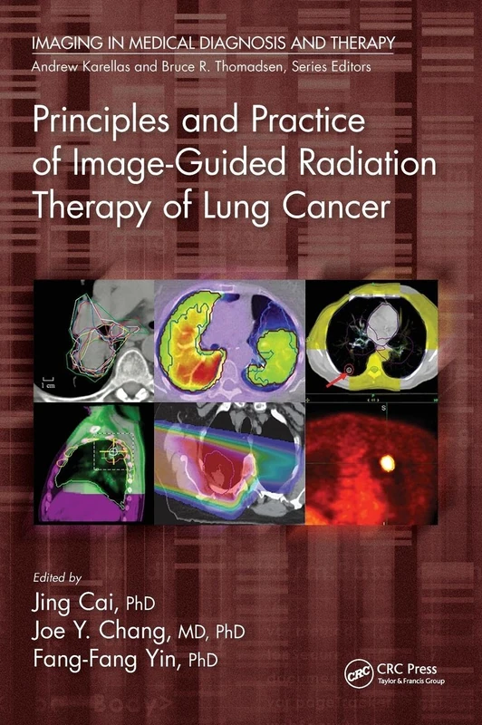 Principles and Practice of Image-Guided Radiation Therapy of Lung Cancer (Imaging in Medical Diagnosis and Therapy)