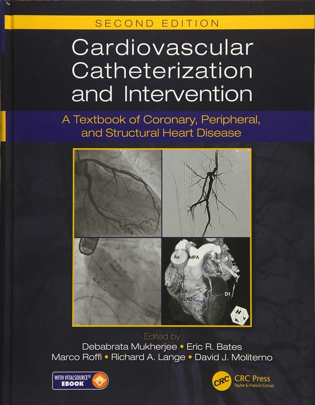 Cardiovascular Catheterization and Intervention: A Textbook of Coronary, Peripheral, and Structural Heart Disease, Second Edition