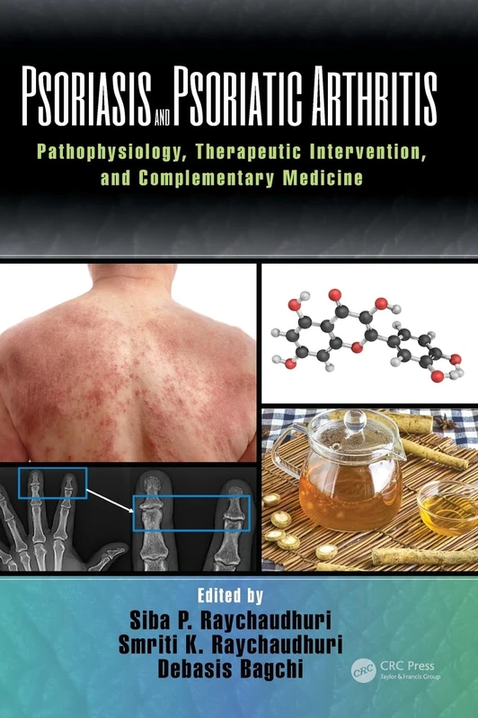 Psoriasis and Psoriatic Arthritis: Pathophysiology, Therapeutic Intervention, and Complementary Medicine