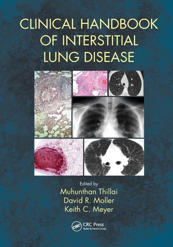 Clinical Handbook of Interstitial Lung Disease