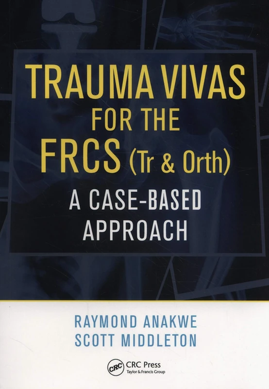 Trauma Vivas for the FRCS: A Case-Based Approach