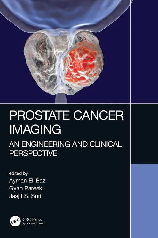 Prostate Cancer Imaging: An Engineering and Clinical Perspective
