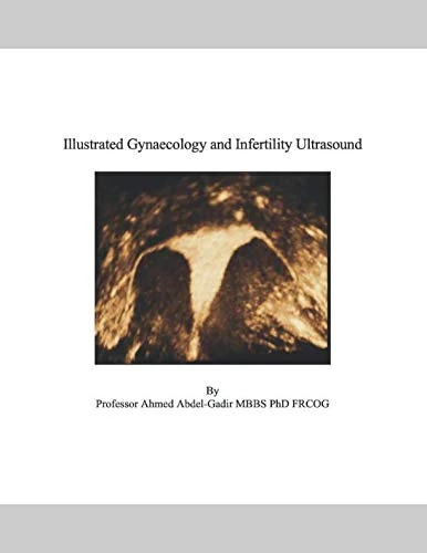 Illustrated Gynaecology and Infertility Ultrasound