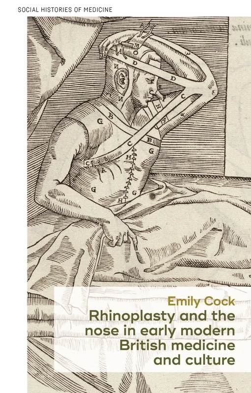 Rhinoplasty and the Nose in Early Modern British Medicine and Culture: 25 (Social Histories of Medicine)