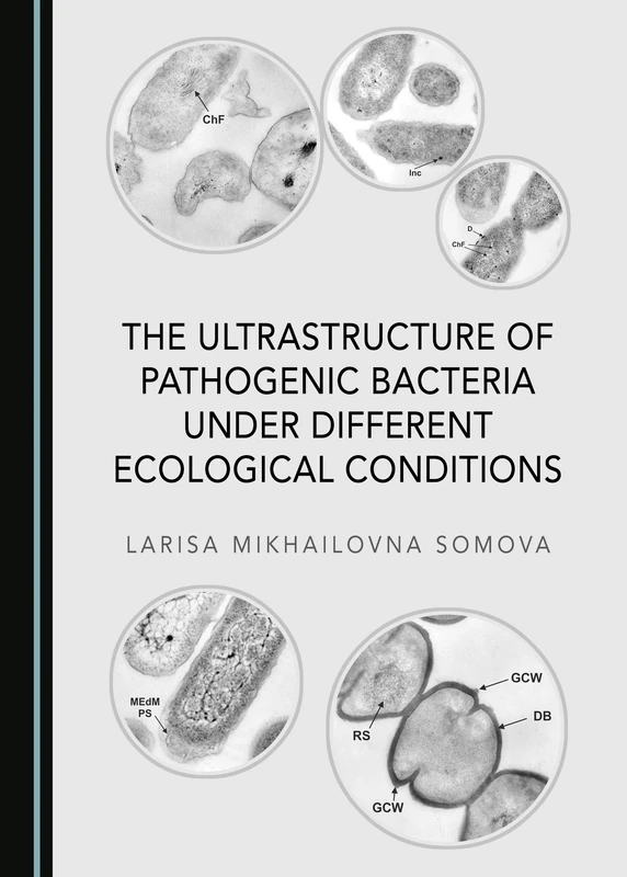 The Ultrastructure of Pathogenic Bacteria under Different Ecological Conditions