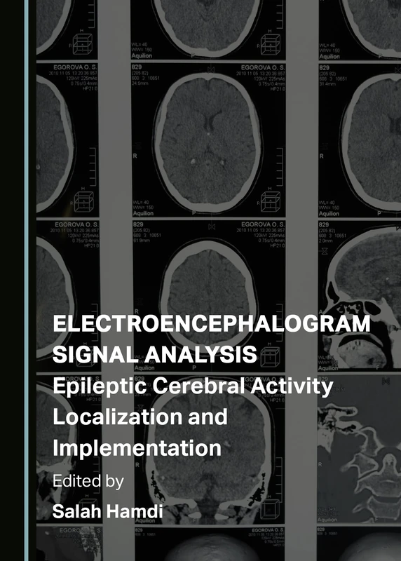 Electroencephalogram Signal Analysis: Epileptic Cerebral Activity Localization and Implementation